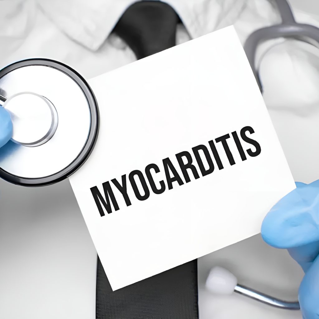 Myocarditis: Causes, Symptoms, and Coping Strategies