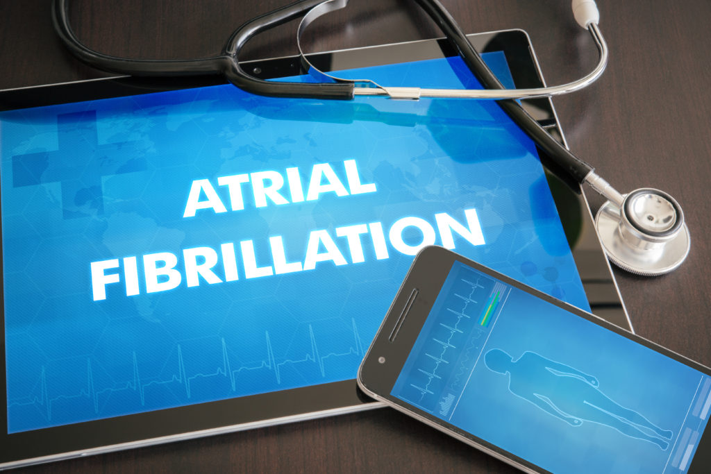 AFib: Understand its impact and how to prevent complications